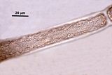 7 - Cellula di un tricoblasto con plastidi